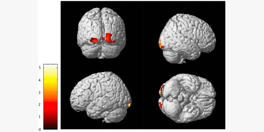 Physical differences. Gray matter Brain. Gray matter in Brain. How Polyglots' Brains different.