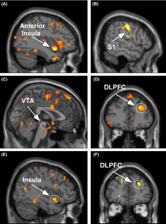 The Highly Sensitive Brain An fMRI Study of Sensory Processing